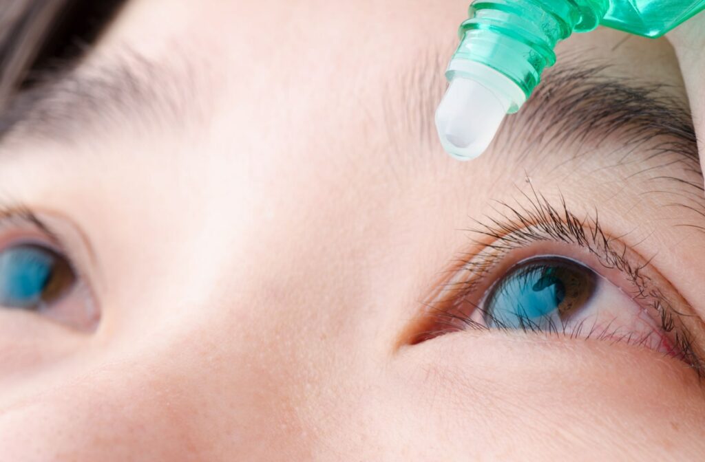 A young woman is applying eye drops on her dry eyes